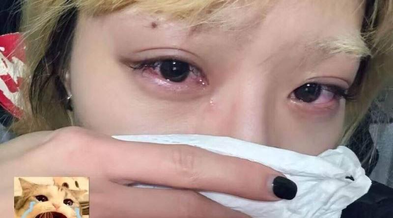 22岁美女惨遭男闺蜜偷袭爆肛 之后直接口交导致感染幽门螺杆菌 在线求助该怎么办 真是炸裂啊！下